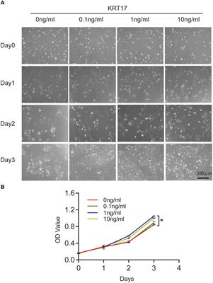 KRT17 from skin cells with high glucose stimulation promotes keratinocytes proliferation and migration